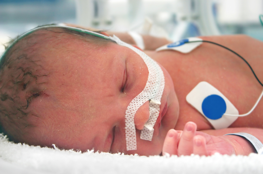 New equipment at KGH will keep the tiniest patients close to home | iNFOnews.ca New equipment at KGH will keep the tiniest patients close to home | iNFOnews.ca