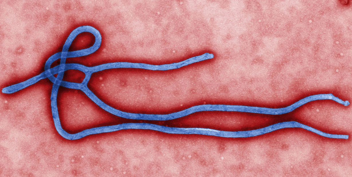 Canada prepping for potential Ebola cases but still sees risk as low: Ambrose | iNFOnews.ca