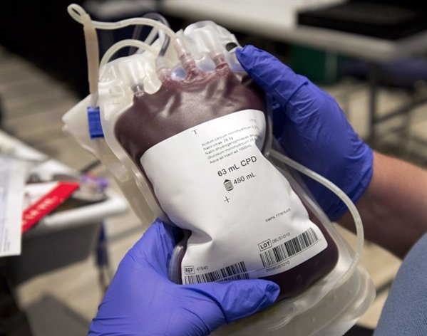 Relaxing restrictions on gay blood donors, maybe | iNFOnews.ca
