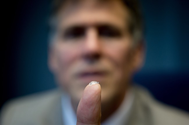 Bionic Lens means perfect vision without ever needing glasses, contacts: B.C. doc | iNFOnews.ca
