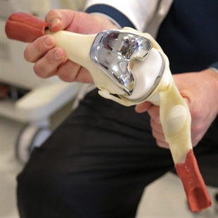 Knee replacement surgery gives more pain relief, but other options also help, study finds | iNFOnews.ca Knee replacement surgery gives more pain relief, but other options also help, study finds | iNFOnews.ca