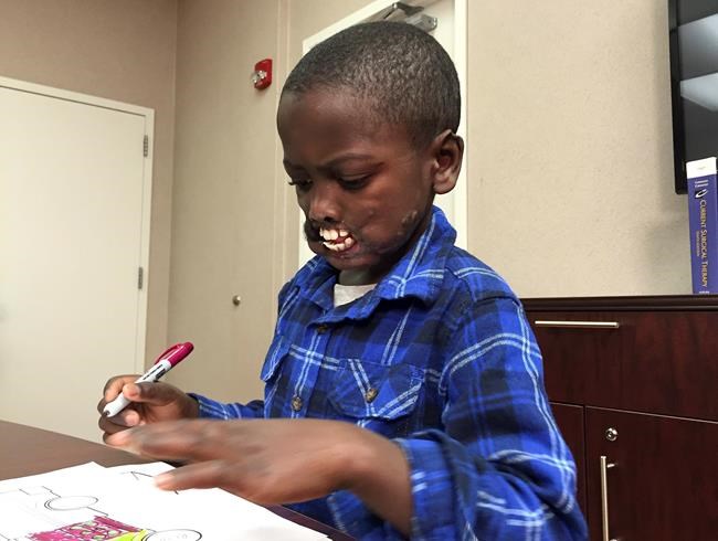 African boy mauled by chimps to undergo facial reconstruction surgery at New York hospital | iNFOnews.ca African boy mauled by chimps to undergo facial reconstruction surgery at New York hospital | iNFOnews.ca