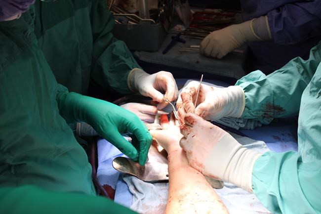 Team of Toronto doctors perform Canada's first hand and forearm transplant | iNFOnews.ca