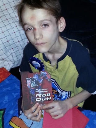 'Utter neglect:' Expert tells trial starving, diabetic teen likely had scurvy | iNFOnews.ca