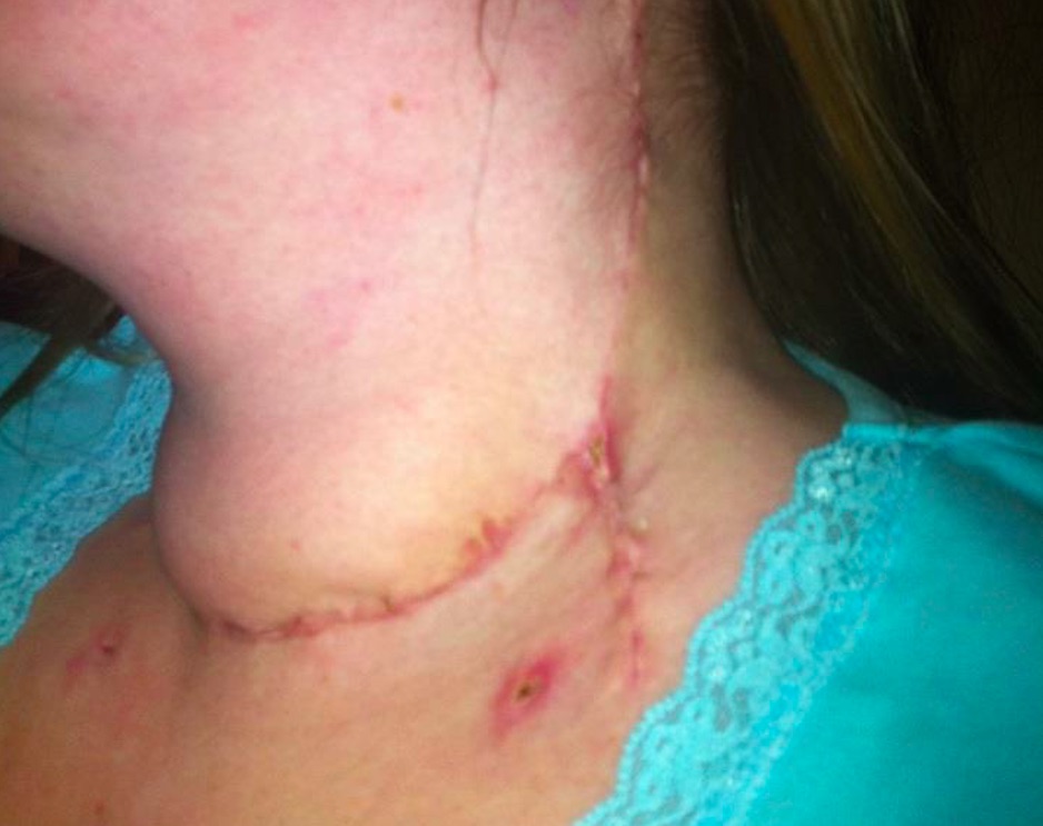 MISDIAGNOSED: What a Vernon woman learned from five-year fight for justice | iNFOnews.ca