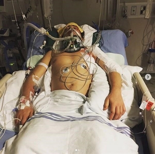 Mark McMorris posts before and after photo after life-threatening crash | iNFOnews.ca