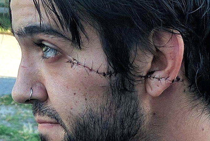 Ben Lee Park face slasher already back in Kelowna court | iNFOnews.ca