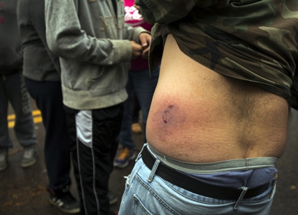 Cop cars set afire, Molotov cocktails tossed at shale gas protest | iNFOnews.ca