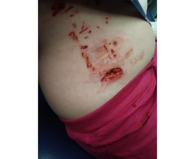 Police dog in Saskatoon bites girl, 6, while tracking home-invasion suspects | iNFOnews.ca