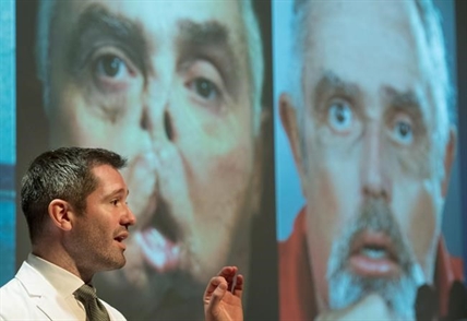 Quebec man doing well as doctors rejoice at first Canadian face transplant | iNFOnews.ca Quebec man doing well as doctors rejoice at first Canadian face transplant | iNFOnews.ca