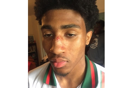 Lawyer calls for review into excessive force allegations from Halifax Police | iNFOnews.ca Lawyer calls for review into excessive force allegations from Halifax Police | iNFOnews.ca