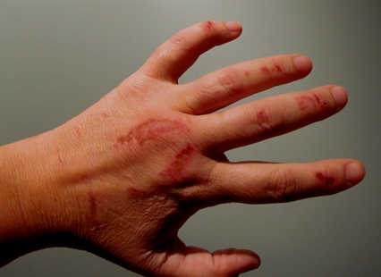 Summerland woman fights off coyotes to defend dog | iNFOnews.ca
