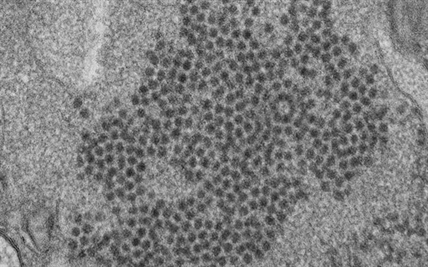 Study points to virus as culprit in kids' paralyzing illness in US | iNFOnews.ca