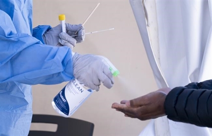 Isolation and sanitation during COVID-19 may affect human microbiome, scientists say | iNFOnews.ca Isolation and sanitation during COVID-19 may affect human microbiome, scientists say | iNFOnews.ca