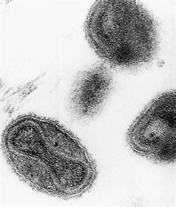 Forgotten vials of smallpox found in US storage room; unclear whether virus is dead or alive | iNFOnews.ca Forgotten vials of smallpox found in US storage room; unclear whether virus is dead or alive | iNFOnews.ca