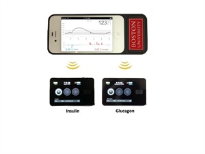 'Bionic pancreas' for Type 1 diabetics passes key test; study finds better blood-sugar control | iNFOnews.ca CP28773053