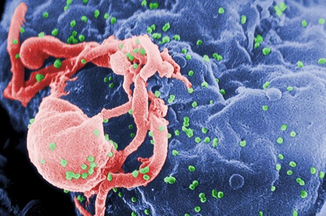 Girl's HIV infection seems under control without AIDS drugs | iNFOnews.ca
