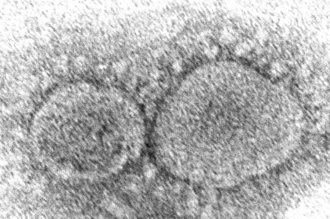 New variants raise worry about COVID-19 virus reinfections | iNFOnews.ca CP2032789838