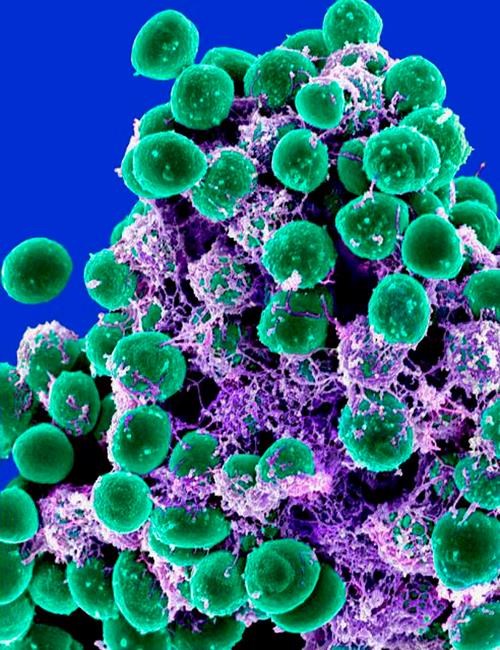 Tracking microbes people carry may predict future health | iNFOnews.ca