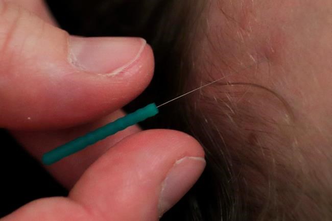 No stethoscope for pain: Scientists seek real way to measure | iNFOnews.ca