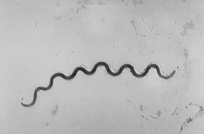 Newborn syphilis cases in US reach highest level in 20 years | iNFOnews.ca