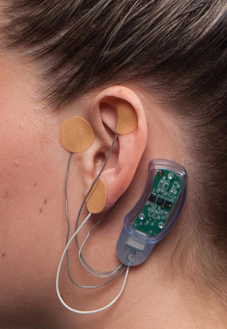FDA clears nerve stimulator to aid recovery from opioids | iNFOnews.ca FDA clears nerve stimulator to aid recovery from opioids | iNFOnews.ca