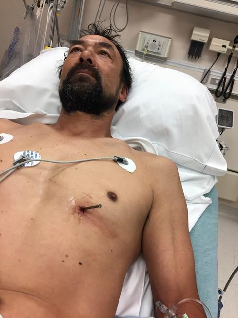 Man drives himself to hospital with nail in his heart | iNFOnews.ca Man drives himself to hospital with nail in his heart | iNFOnews.ca