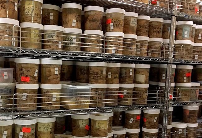 New evidence that viruses may play a role in Alzheimer's | iNFOnews.ca