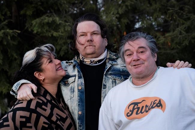 'New chance at life': Man gets face, hands in rare surgery | iNFOnews.ca