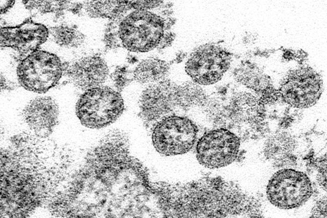 Silver lining? Cases of infectious diseases plunge amid anti-COVID measures | iNFOnews.ca Silver lining? Cases of infectious diseases plunge amid anti-COVID measures | iNFOnews.ca