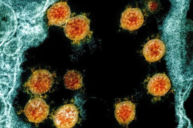 The latest numbers on COVID-19 in Canada for Oct. 6 | iNFOnews.ca The latest numbers on COVID-19 in Canada for Oct. 6 | iNFOnews.ca
