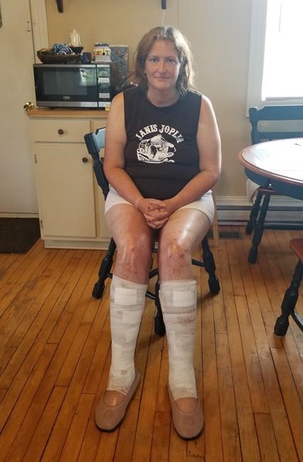 New Brunswick woman found after missing in forest for almost two weeks | iNFOnews.ca