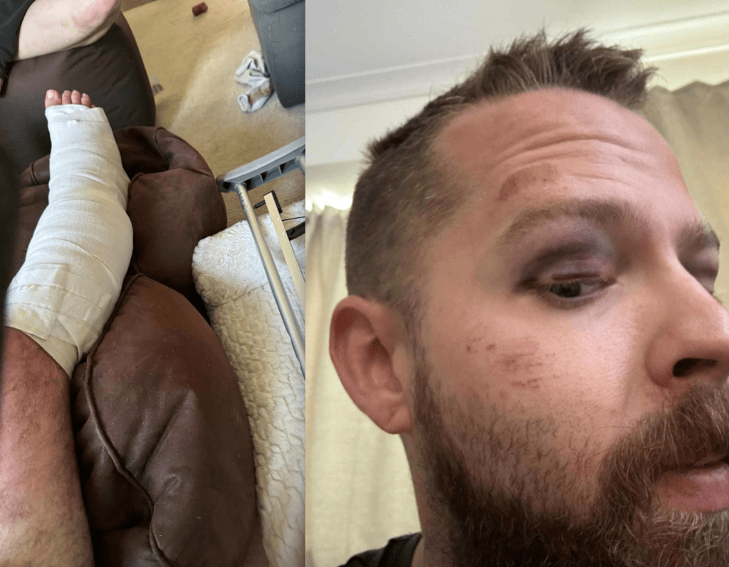 Penticton couple on evening bicycle ride violently attacked | iNwheels