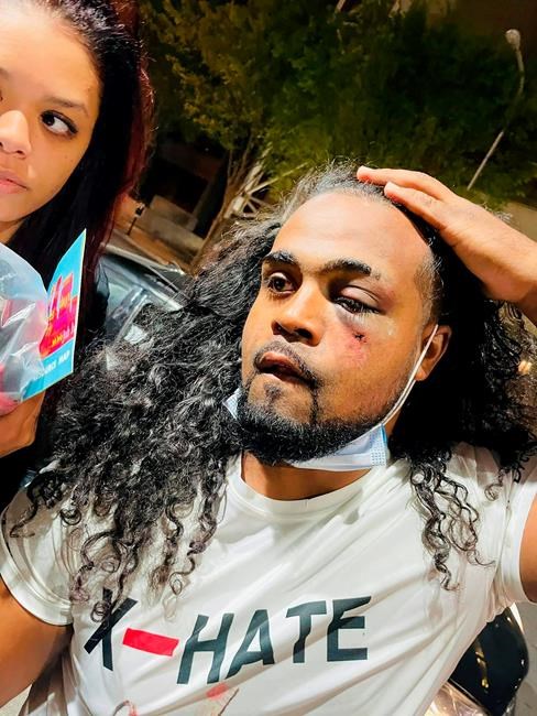 Video: Louisville officer punches protester during arrest | iNFOnews.ca