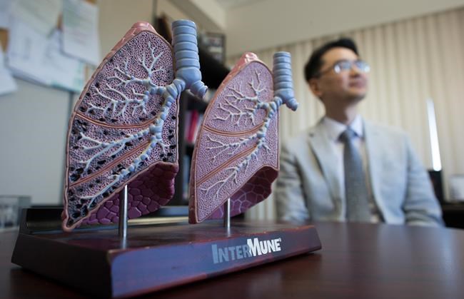 Crystal ball-like web tool could help patients with lung disease: B.C. doctor | iNFOnews.ca CP2026775620