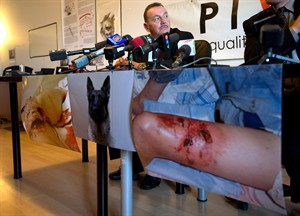 Dog bites top police injury list, need regulation: legal advocacy group | iNFOnews.ca CP28917678