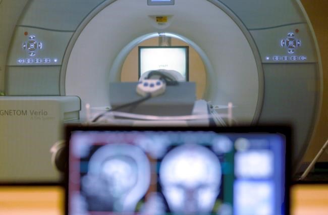 Slippery slope: Study finds little lies lead to bigger ones | iNFOnews.ca