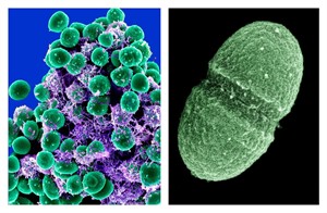 Your underarm's the rainforest, your gut the ocean: Body's bacterial zoos keep people healthy | iNFOnews.ca CP18786750