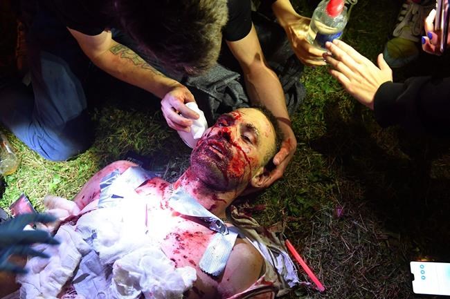 Protester dies in clashes after disputed Belarus vote | iNFOnews.ca Protester dies in clashes after disputed Belarus vote | iNFOnews.ca