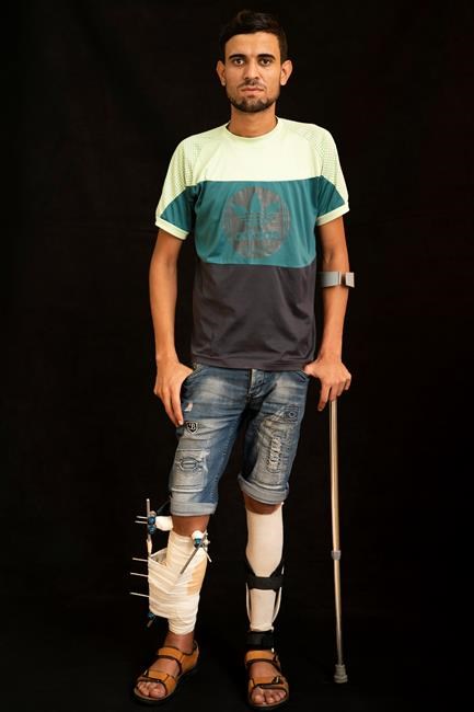In Gaza protests, Israeli troops aim for the legs | iNFOnews.ca In Gaza protests, Israeli troops aim for the legs | iNFOnews.ca