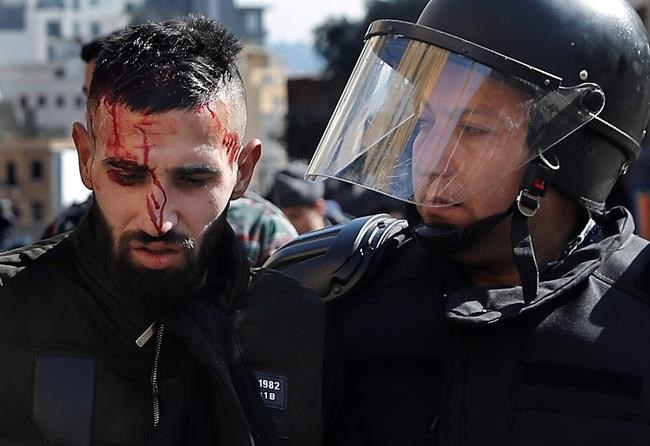 Bloodied but determined, Lebanese protesters take stock | iNFOnews.ca