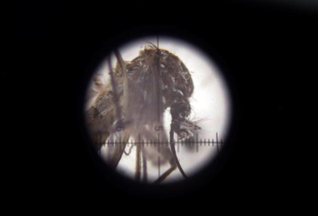 Honduras reports 8 babies born with Zika-related defects | iNFOnews.ca CP114720489