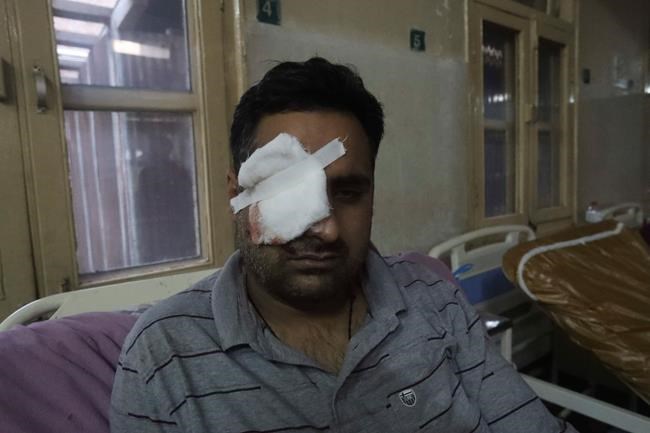 Anti-India clashes continue in tense Kashmir for 3rd day | iNFOnews.ca Anti-India clashes continue in tense Kashmir for 3rd day | iNFOnews.ca