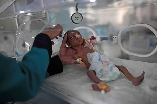 UN warns of Yemen famine, no aid from Saudis, UAE, Kuwait | iNFOnews.ca UN warns of Yemen famine, no aid from Saudis, UAE, Kuwait | iNFOnews.ca