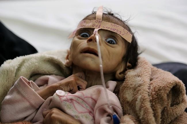 From destruction to cholera, Yemen war brings disasters | iNFOnews.ca From destruction to cholera, Yemen war brings disasters | iNFOnews.ca