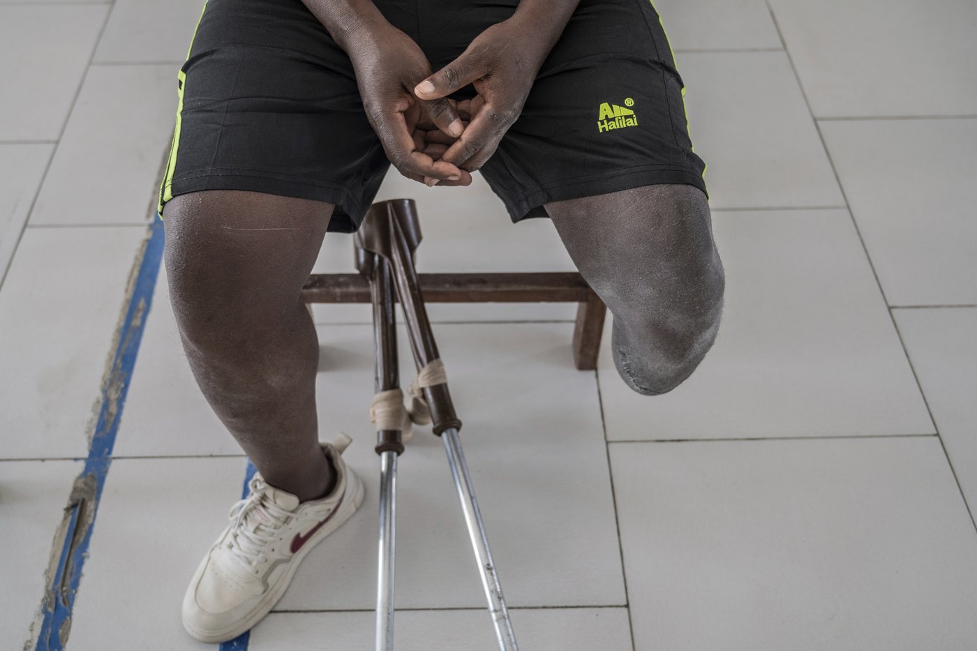 Photos of an orthopedic center in Congo that helps amputees regain mobility | iNFOnews.ca