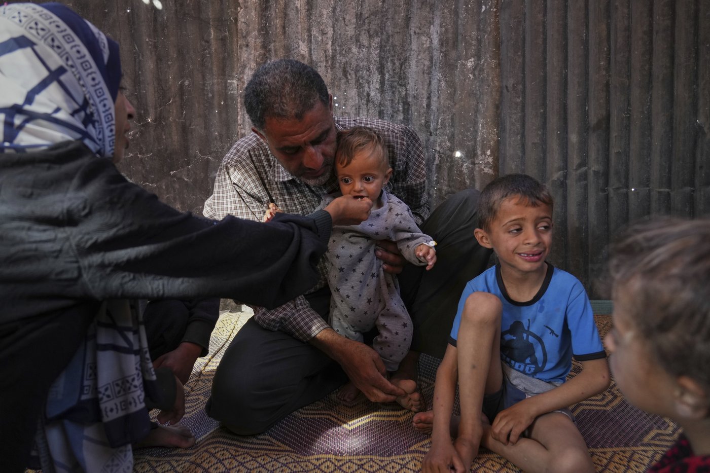 Takeaways from AP's reporting on child malnutrition in Gaza | iNFOnews.ca
