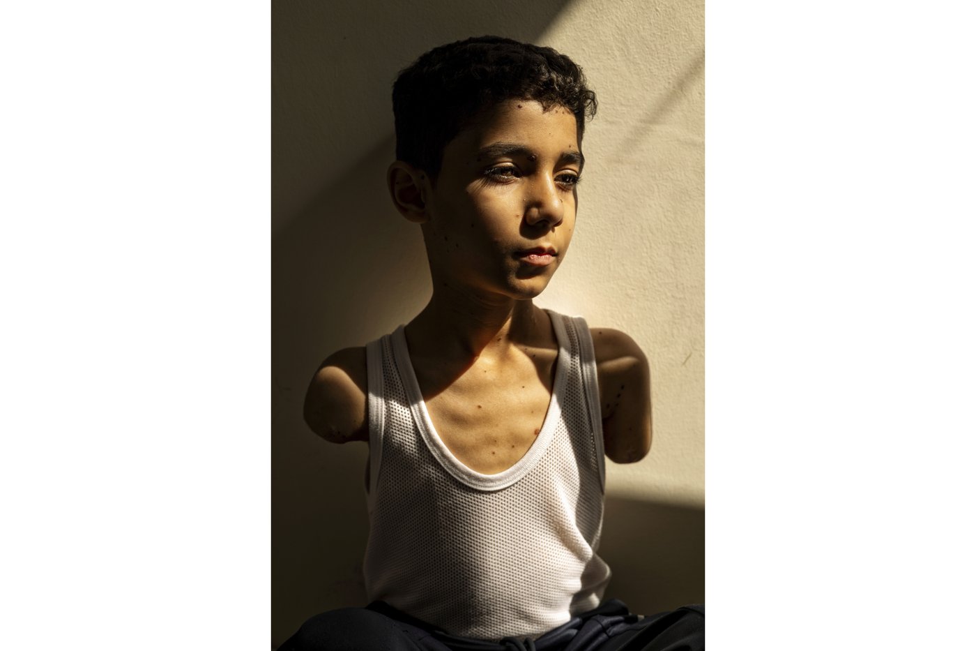 Portrait of Palestinian boy who lost both arms is World Press Photo of the year for 2025 | iNFOnews.ca Portrait of Palestinian boy who lost both arms is World Press Photo of the year for 2025 | iNFOnews.ca