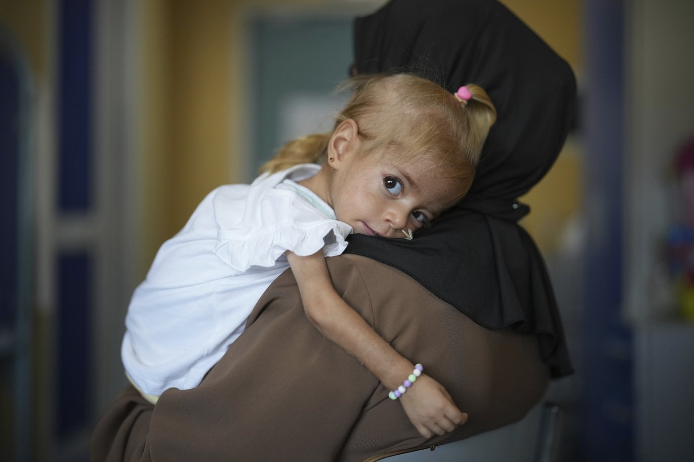 Toddler evacuated from Gaza with rare disease recovers from malnutrition in Italian hospital | iNFOnews.ca