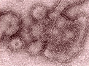 New swine flu virus re-emerges in U.S.; four people infected at county fair | iNFOnews.ca CP19532604